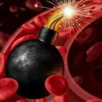 Eordaialive.com - Τα Νέα της Πτολεμαΐδας, Εορδαίας, Κοζάνης Παγκόσμια Ημέρα Δρεπανοκυτταρικής Αναιμίας - Κληρονομική νόσος με σοβαρές επιπτώσεις