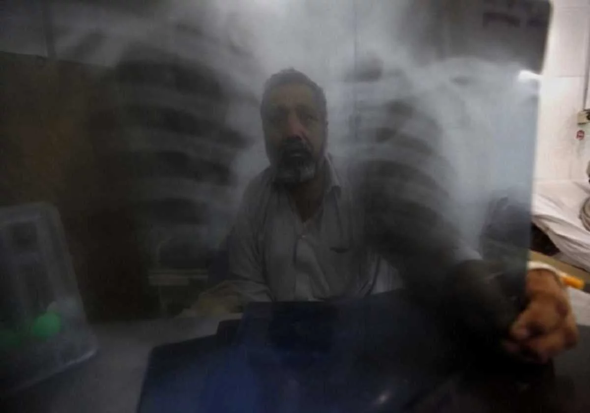 Eordaialive.com - Τα Νέα της Πτολεμαΐδας, Εορδαίας, Κοζάνης Το κάπνισμα η σημαντικότερη αιτία πρόωρων θανάτων στην ΕΕ