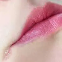 Eordaialive.com - Τα Νέα της Πτολεμαΐδας, Εορδαίας, Κοζάνης Χείλη που σκάνε: Πότε δημιουργούνται «κοψίματα» στις άκρες – Τι να κάνετε
