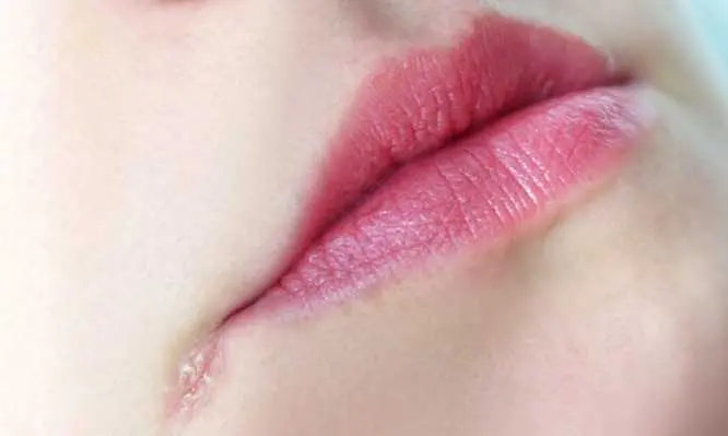 Eordaialive.com - Τα Νέα της Πτολεμαΐδας, Εορδαίας, Κοζάνης Χείλη που σκάνε: Πότε δημιουργούνται «κοψίματα» στις άκρες – Τι να κάνετε