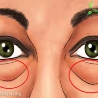 Eordaialive.com - Τα Νέα της Πτολεμαΐδας, Εορδαίας, Κοζάνης 11 σπιτικά γιατροσόφια για να απαλλαγείτε γρήγορα από τους μαύρους κύκλους και τις σακούλες στα μάτια