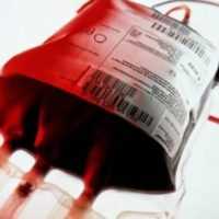 Eordaialive.com - Τα Νέα της Πτολεμαΐδας, Εορδαίας, Κοζάνης Επείγουσα έκκληση για Αιμοπετάλια
