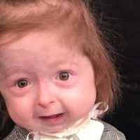 Eordaialive.com - Τα Νέα της Πτολεμαΐδας, Εορδαίας, Κοζάνης 2χρονο κοριτσάκι πάσχει από σπάνια ασθένεια που την γερνάει πρόωρα