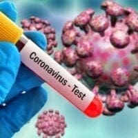 Κορονοϊός: Πού εντοπίζονται τα 1.547 νέα κρούσματα - Eordaialive.com