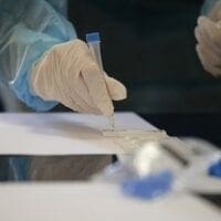 Κορονοϊός: Τι απαντά ο ΕΟΔΥ στα περί ύπαρξης παράλληλων συστημάτων καταγραφής κρουσμάτων - Eordaialive.com