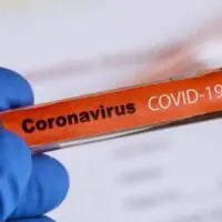 Συντονιστική Επιτροπή Ενημέρωσης της Π.Ε. Κοζάνης για την πανδημία COVID-19