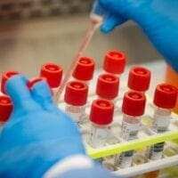 Κορωνοϊός: Η γεωγραφική κατανομή των κρουσμάτων του 24ωρου - Eordaialive.com