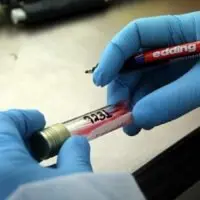 Κορωνοϊός: Το τεστ αίματος που ανιχνεύει σε μία ώρα όσους θα νοσήσουν βαριά