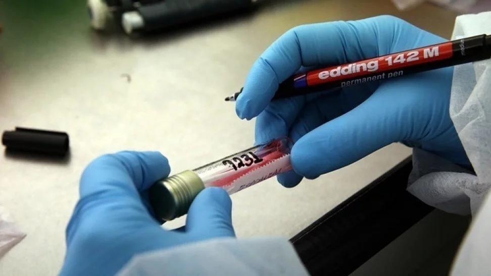 Κορωνοϊός: Το τεστ αίματος που ανιχνεύει σε μία ώρα όσους θα νοσήσουν βαριά
