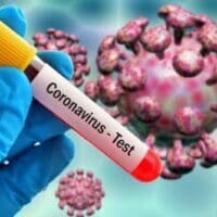 Κοζάνη: Τα … ορφανά κρούσματα του SARS-COV 2