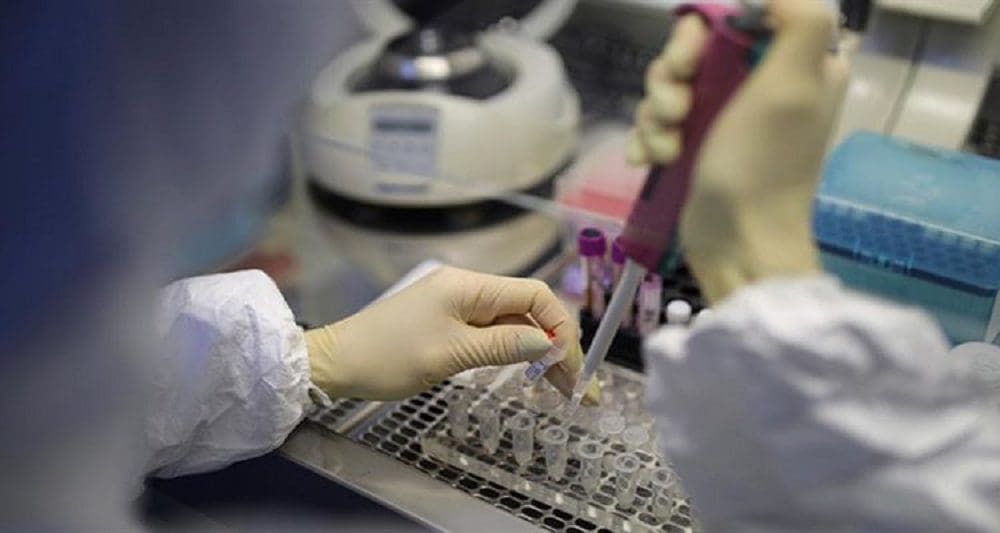 Κορωνοϊός: 2.595 νέα κρούσματα, 20 θάνατοι, 207 διασωληνωμένοι - Eordaialive.com