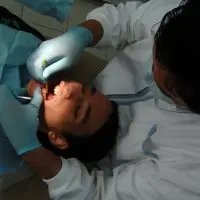 Έτσι θα πηγαίνουμε στα οδοντιατρεία: Πότε χρειάζεται rapid test