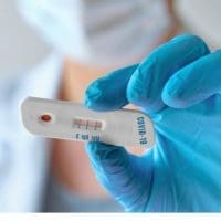 Κορονοϊός: Τι διευκρινίζει η Επιτροπή Ανταγωνισμού για τα rapid test - Eordaialive.com