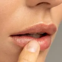5 μυστικά για να αποφύγουμε τα σκασμένα χείλη – Πώς φτιάχνουμε το τέλειο σπιτικό lip balm