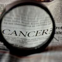 Καρκίνος: Τα επόμενα 10-15 χρόνια θα είναι μια νόσος που δεν θα σκοτώνει, λέει χειρουργός ογκολόγος