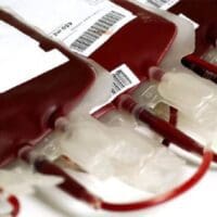 Πτολεμαΐδα: 100 φιάλες αίματος σε μία ημέρα συγκεντρώθηκαν στο Μποδοσάκειο Νοσοκομείο