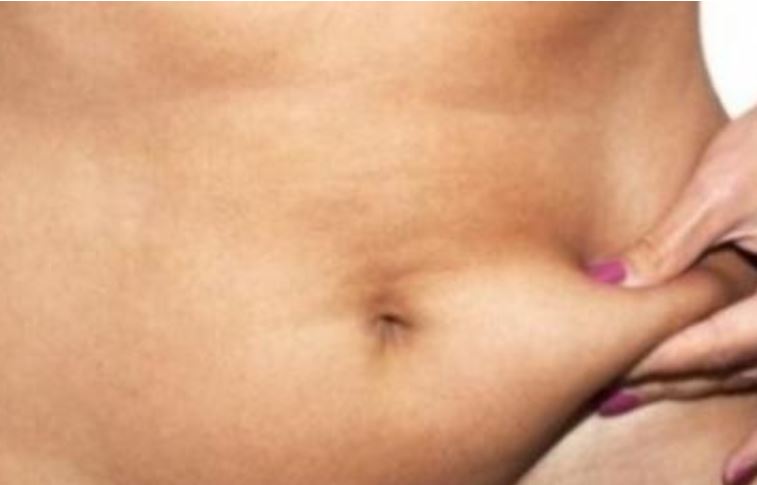 Λίπος στην κοιλιά: Πέντε συνήθειες που βοηθούν να χαθεί